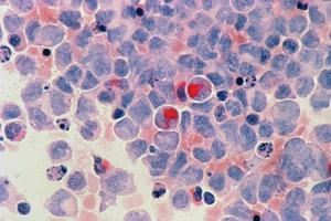 Asociatyvi nuotrauka